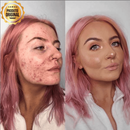 Combo Beleza Plena: Base BB Cream® + Balm Facial Rejuvenescedor Derol®