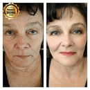 Combo Beleza Plena: Base BB Cream® + Balm Facial Rejuvenescedor Derol®