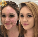 Combo Beleza Plena: Base BB Cream® + Balm Facial Rejuvenescedor Derol®